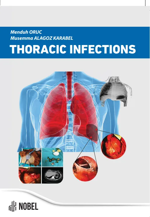 libraryturk.com thoracic ınfections