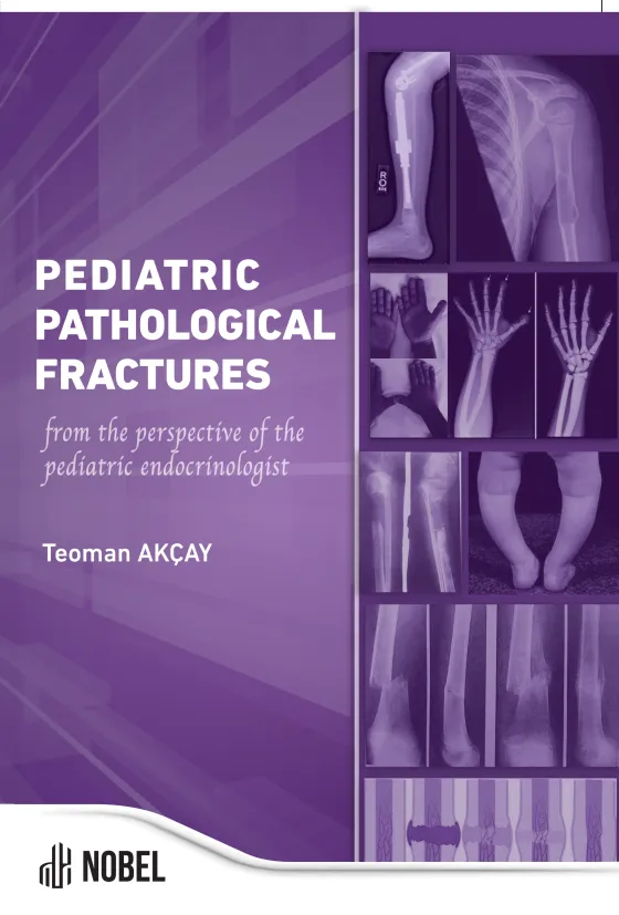 libraryturk.com pediatric pathological fractures: from the perspective of the pediatric endocrinologist