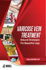 libraryturk.com varicose vein treatment: natural strategies for beautiful legs
