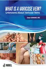 libraryturk.com what ıs a varicose vein? unknowns about varicose veins